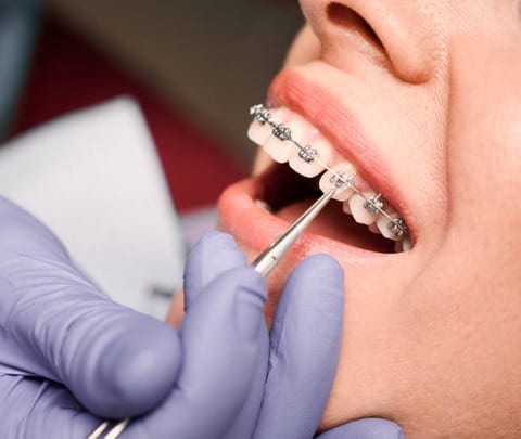 Orthodontics work
